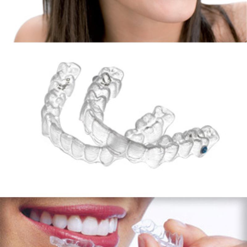 Ортодонтическое лечение прозрачными элайнерами  INVISALIGN TEEN  для подростков
