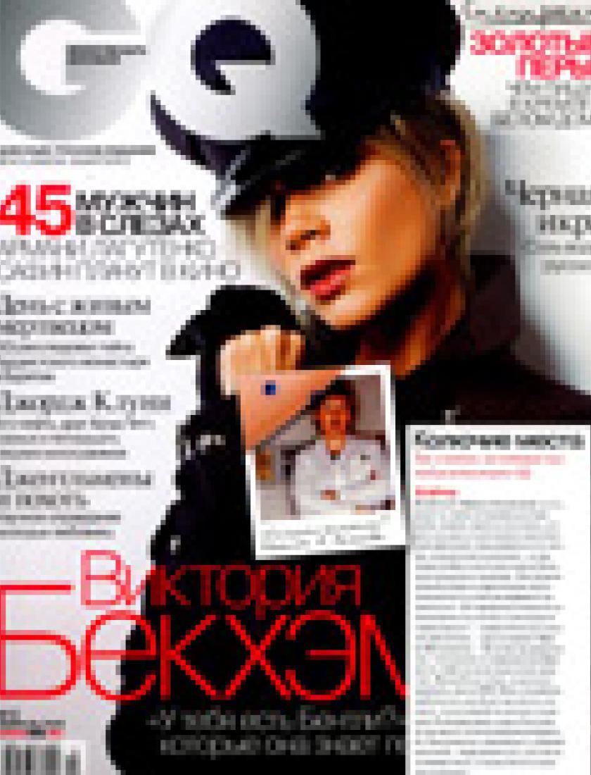 Иглорефлексотерапия (GQ, февраль 2006)