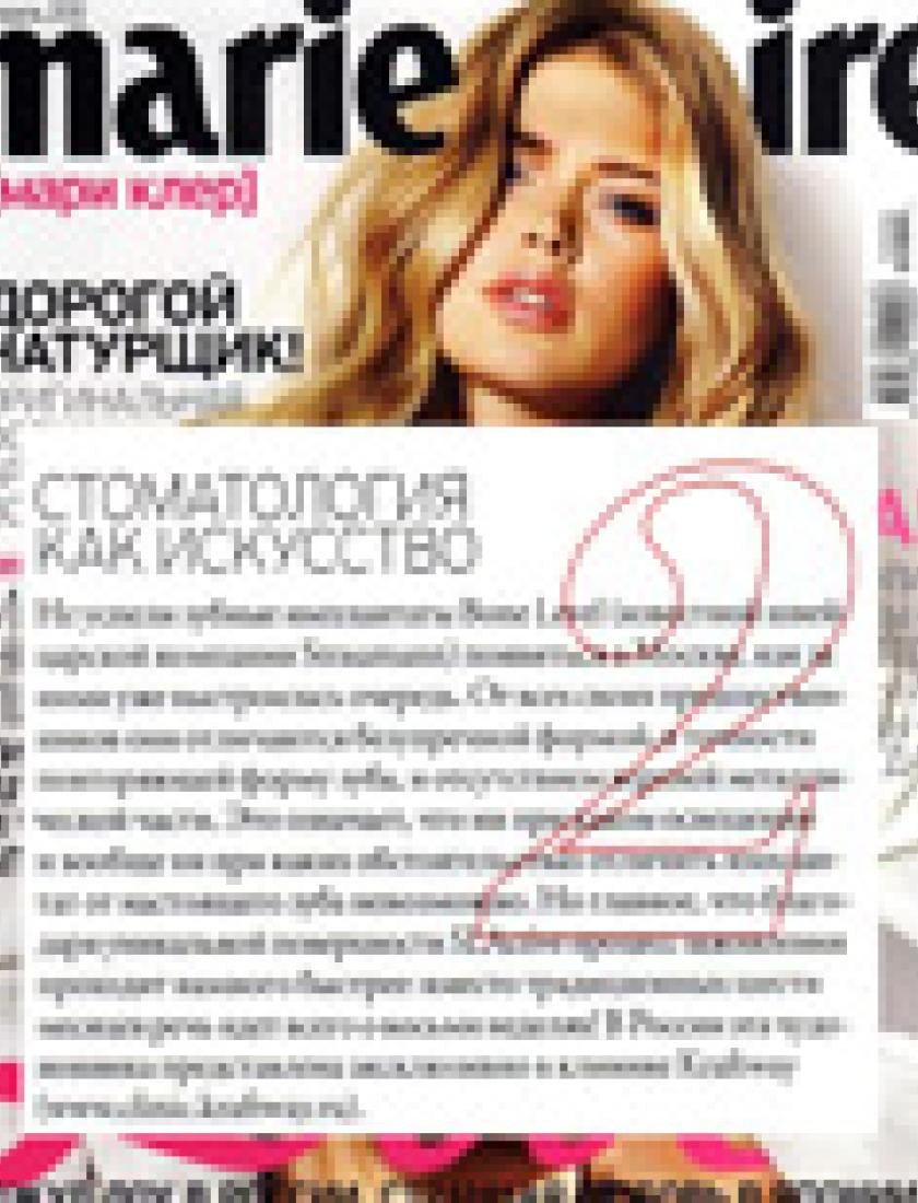 Швейцарские импланты Bone Level (Marie Claire, апрель 2010)