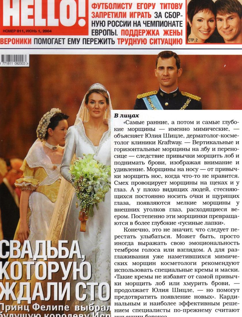 Методики борьбы с мимическими морщинами (Hello, июнь 2004)